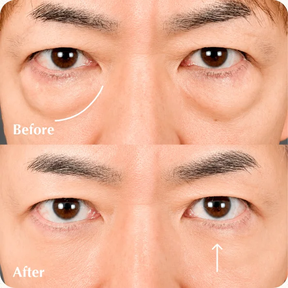 症例写真 Before/After
