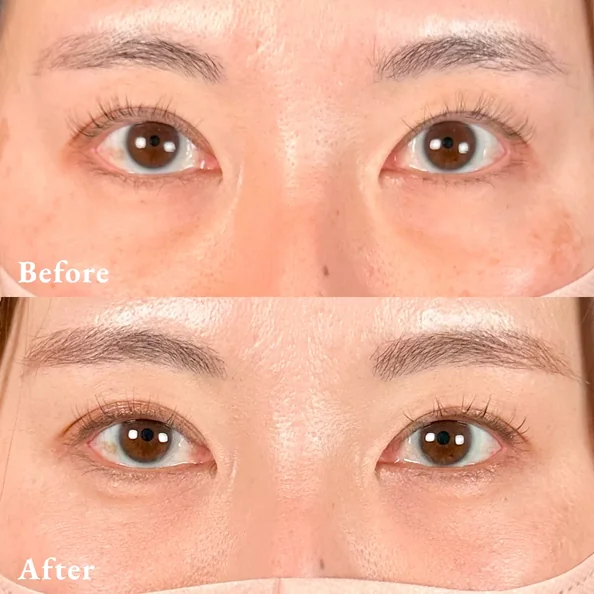症例写真 Before/After