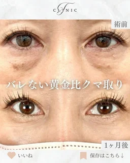 Instagram 症例投稿2