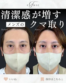 Instagram 症例投稿3