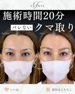 Instagram 症例投稿4