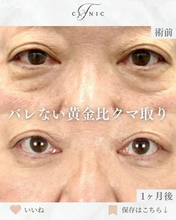 Instagram 症例投稿5