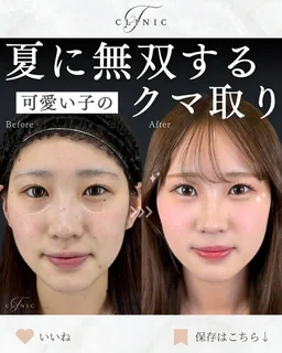 Instagram 症例投稿6
