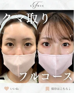 Instagram 症例投稿7