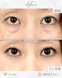 Instagram 症例投稿8